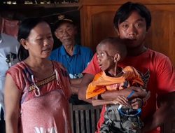 Kondisi Bocah Berusia 9 Tahun di Blora Pengidap Komplikasi
