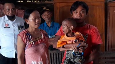 Kondisi Bocah Berusia 9 Tahun di Blora Pengidap Komplikasi