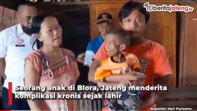 [Video] Komplikasi Paru, Bocah di Blora Kurus Kering dan Tak Bisa Jalan
