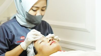 Immoderma Skin Clinic Supriyadi Soft Opening, Beri Banyak Promo Perawatan Wajah dan Tubuh