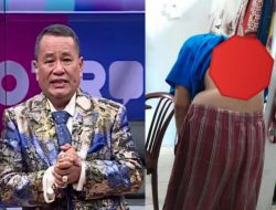 Viral! Kasus Nayya Annesa Korban KDRT dan Penganiayaan Telah Ditangani oleh Hotman Paris dan Tim 911
