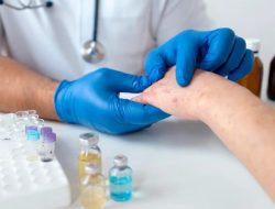 Cara Mengatasi Masalah Lupus Nefritis, Penyakit yang Sebabkan Penyanyi Shena Malsiana Meninggal Dunia