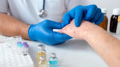 Cara Mengatasi Masalah Lupus Nefritis, Penyakit yang Sebabkan Penyanyi Shena Malsiana Meninggal Dunia