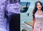 Ping Chayada Penyanyi Asal Thailand yang Meninggal Dunia Usai Pijat Leher, Begini Gejalanya