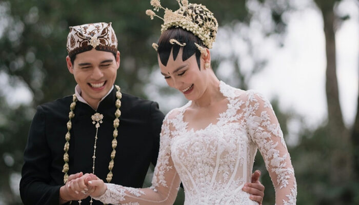 Terungkap! Luna Maya Lakukan 5 Treatment ini Menjelang Pernikahan, Manfaatnya Banyak Sekali