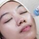 Immoderma Clinic Kenalkan Remee Pro, Teknologi Injeksi Presisi untuk Skinbooster Lebih Optimal